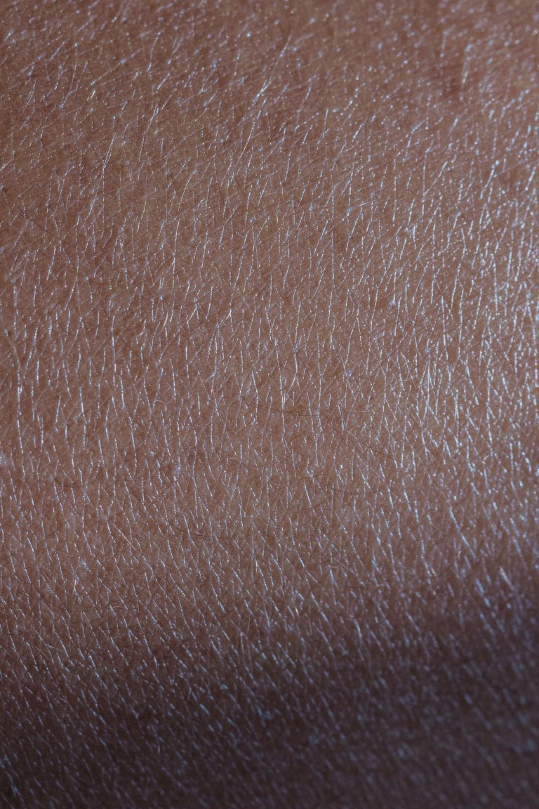Peau cendrée et grise : hydrater une peau noire qui tire